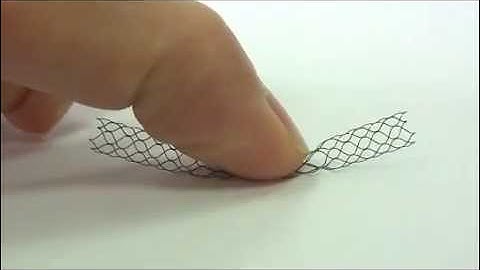 Nitinol stent - elastic memory
