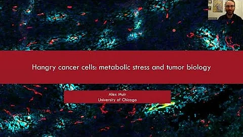 Hangry cancer cells: metabolic stress and tumor biology