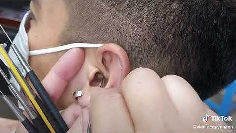 limpeza do ouvido | Cera de ouvido#9