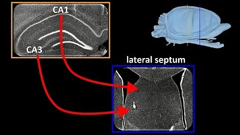 Transformation of the Hippocampal Cognitive Map