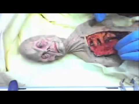 shocking video of alien autopsy in Russia in 1969 UFO OVNI. (autpsia a alien en rusia en 1969)