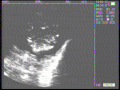 Sheep Ultrasound Capture