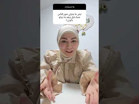 وانتو شو رأيكم وبرضو نسيت احكي انو في كتير حالات ما بتحب تتصور وبحترم جدا هالشي لانو خاص