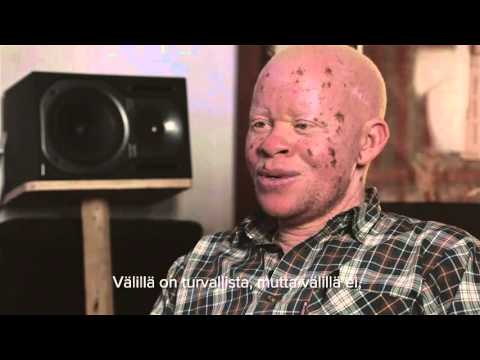 Video: Albinismin Taakka: Rasituksen Arviointityökalun Kehittäminen Ja Validointi