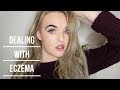 Tips for Coping With Eczema