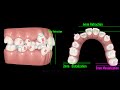 Invisalign Four Premolar Extraction Moderate Anchorage【How change Staging for tooth movement】