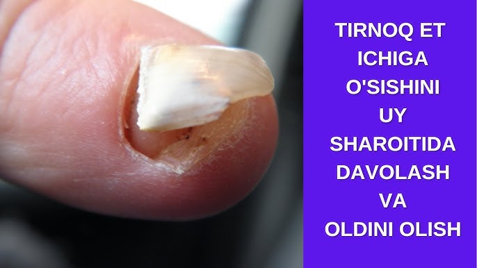 Siydik favvorasi bilan ayol orgazmi