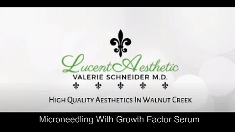 Microneedling at Lucent Aesthetic with Growth Factor Serum