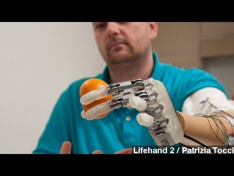 Prosthetic Hand Gives User Ability To Feel, Sense Objects