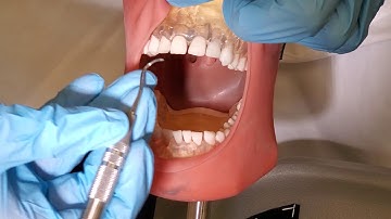 Lab #11 Part 2 Adaptation