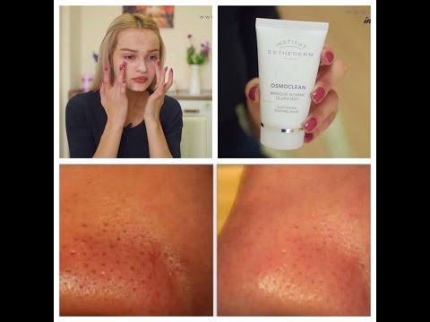 კანის ღრმა წმენდა