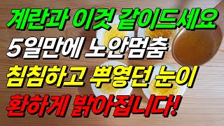 Download Lagu 5일만에 노안멈춤! 계란과 이것 같이드세요. 침침하고 뿌옇던 눈이 환하게 밝아집니다. “30초만에 눈이 좋아지는 방법” #눈건강 #노안 #계란 MP3 Download Lagu 5일만에 노안멈춤! 계란과 이것 같이드세요. 침침하고 뿌옇던 눈이 환하게 밝아집니다. “30초만에 눈이 좋아지는 방법” #눈건강 #노안 #계란 MP3