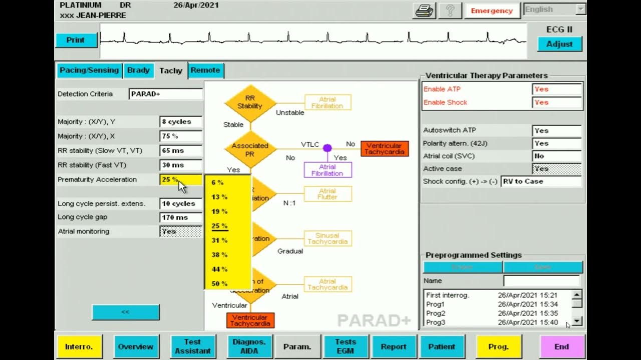 ICD interrogation 3. Parameters YouTube