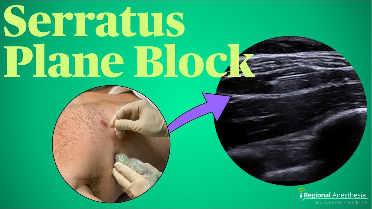 Блок зубчатой ​​плоскости