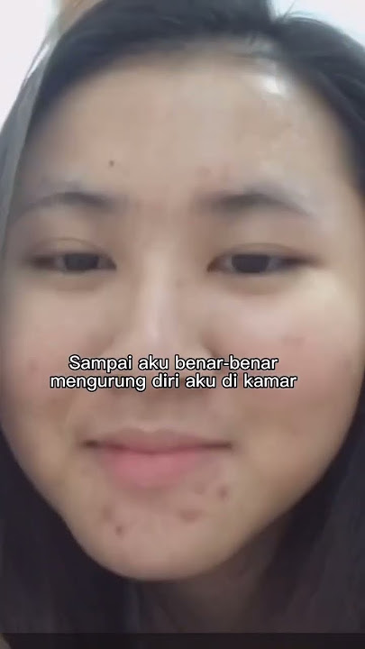 KISAH SINGKAT PERJUANGAN JERAWAT AKU!🥺