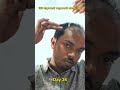 Day 36 | 180 days hair regrowth challenge #hairstyle #manmatters #hairfallsolution