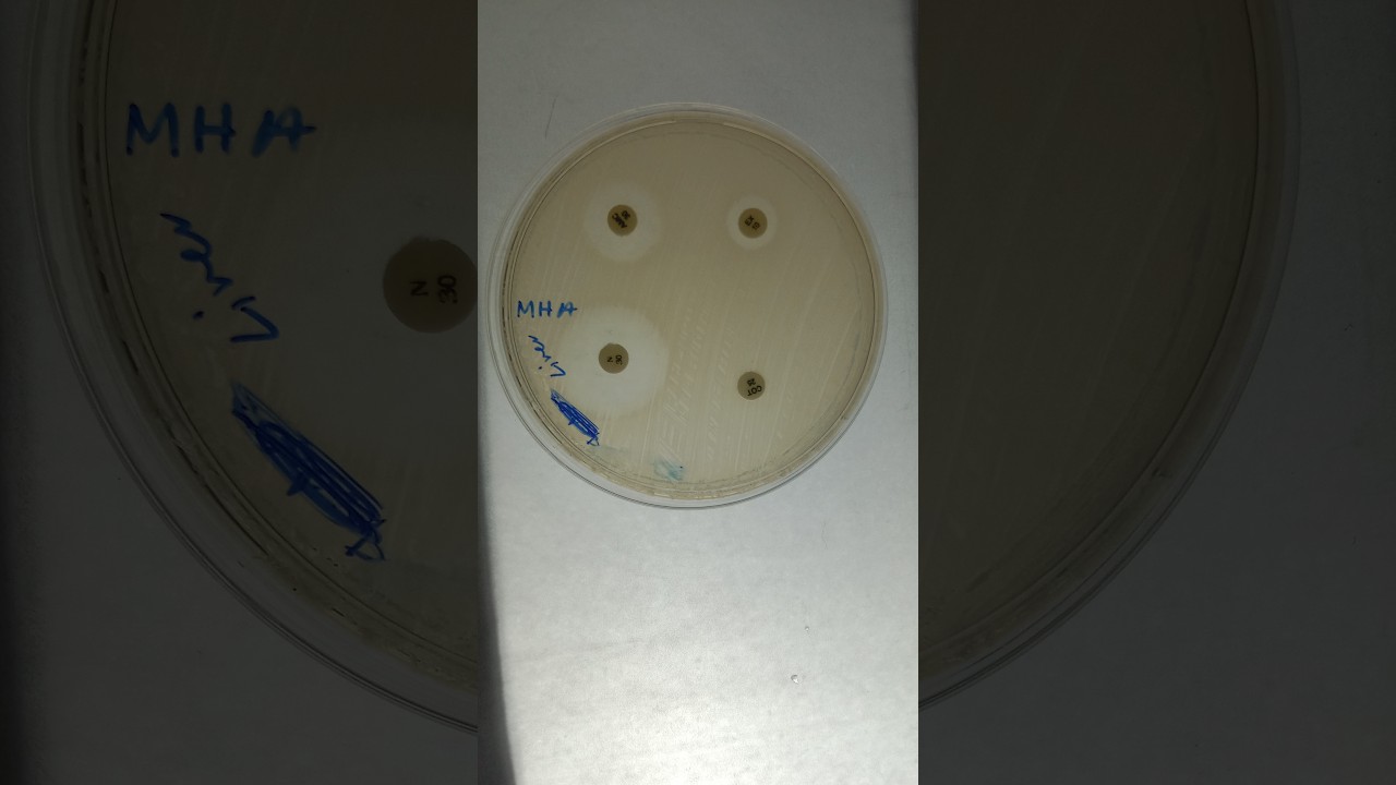 The Kirby-Bauer Disc Diffusion Method #ABST #ANTIBIOTIC_SUSCEPTIBILITY ...