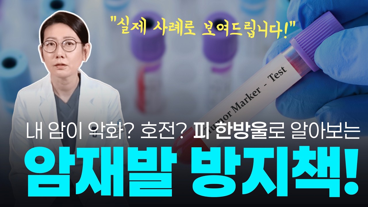 암진단과 예후, 재발감시까지 열일하는 종양표지자 검사!