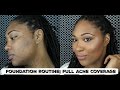 Foundation Routine| Full Acne Coverage