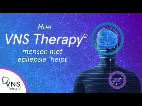 Video: VNS-therapie Voor Epilepsie: Installatie, Bijwerkingen En Meer