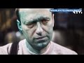 Навальный получил химический ожог глаза в результате нападения с зеленкой