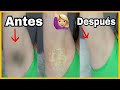 REMEDIO CASERO QUE BLANQUEA TUS AXILAS EN 10 MINUTOS | ACLARA TUS AXILAS EN CASA | NatyGloss