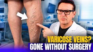 20 Years Treating Varicose Veins: What I Want You to Know