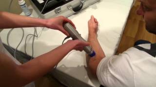 Tenosynovitis of the Elbow Treatment with Zimmer enPuls