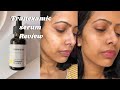 Be minimalist  tranexamic brightening serum Review 💛  tried it on my skin pigmentation