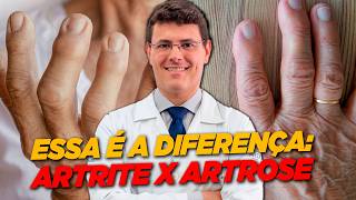 Artrite ou artrose? Descubra a diferença e o que realmente importa