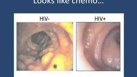 Prof Francois Venter: HIV vaccines - where are we in 2012? September 2012