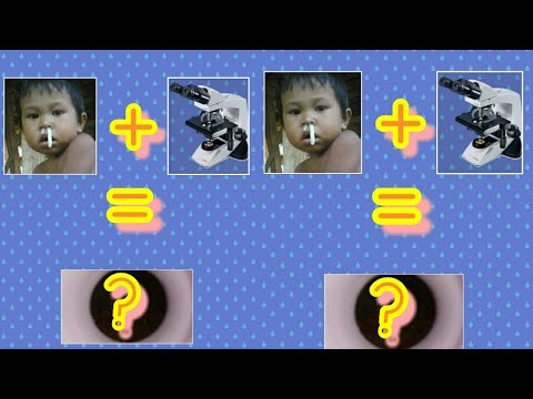 Seperti apa sih ingus jika dilihat di Mikroskop? 