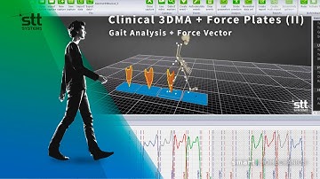 Gait Analysis + Force Vector | Clinical 3DMA + Force Plates (II)