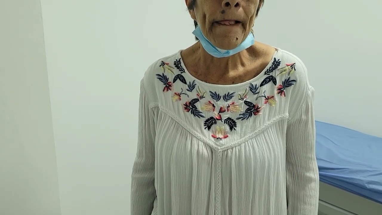 Corea de Huntintong movimientos