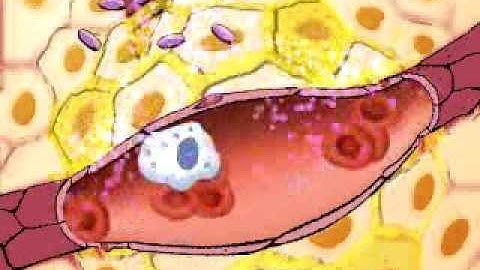 Inflammation  | Histamine | Phagocyte