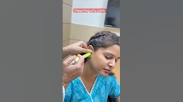 Taking Ear Measurements for Bernafon Invisible Hearing Aid | Custom Fit for Hearing Loss & Tinnitus.