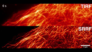 Super-resolution imaging of microtubule dynamics imaged using SRRF