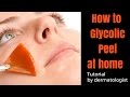 How to Glycolic Peel at HOME