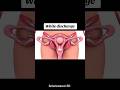 White Discharge Period First Daypainfullprocess Inside View Period Process Human Anatomy Foryou White Discharge Period First Daypainfullprocess Inside View Period Process Human Anatomy Foryou