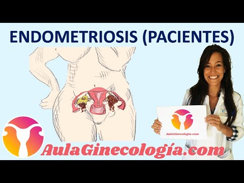 Video: 3 formas de afrontar los síntomas de la endometriosis