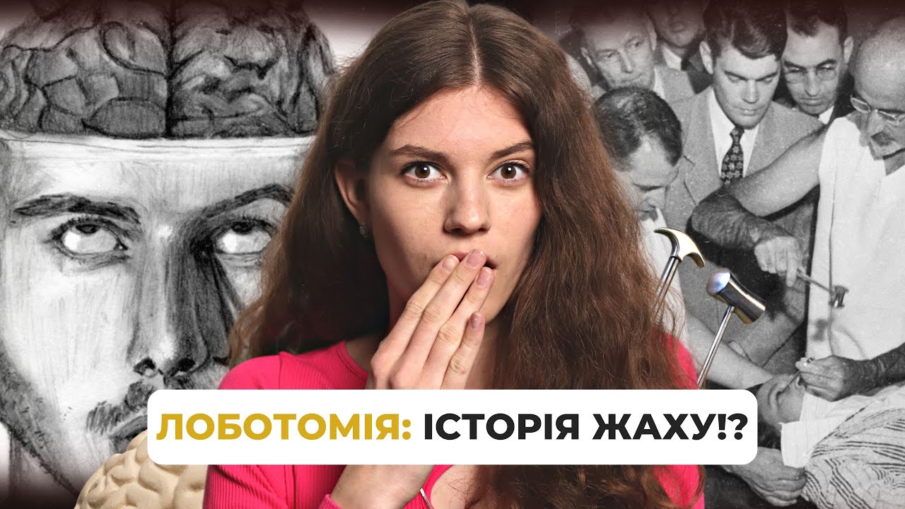 ЛОБОТОМІЯ. Нобелівська премія, яка РУЙНУВАЛА МІЗКИ ЛЮДЕЙ [Темна сторона ...