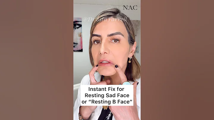 #daobotox #restingsadface #restingbface #botox #filler #drbitafarrell