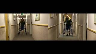 Before & After: knee hyperextension | DAFO FlexiSport