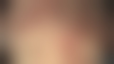 Macroscopic Features of Ulcerative Colitis with Low, Moderate, and Severe Activities