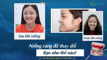 Niềng răng đã thay đổi bạn như thế nào?
