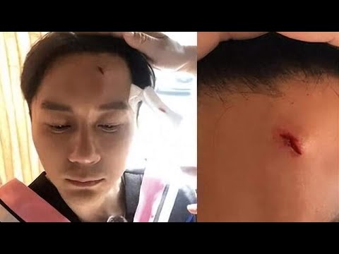 汪小菲直播回应“被打”真相！同时回应大S教育孩子问题隐深思！
