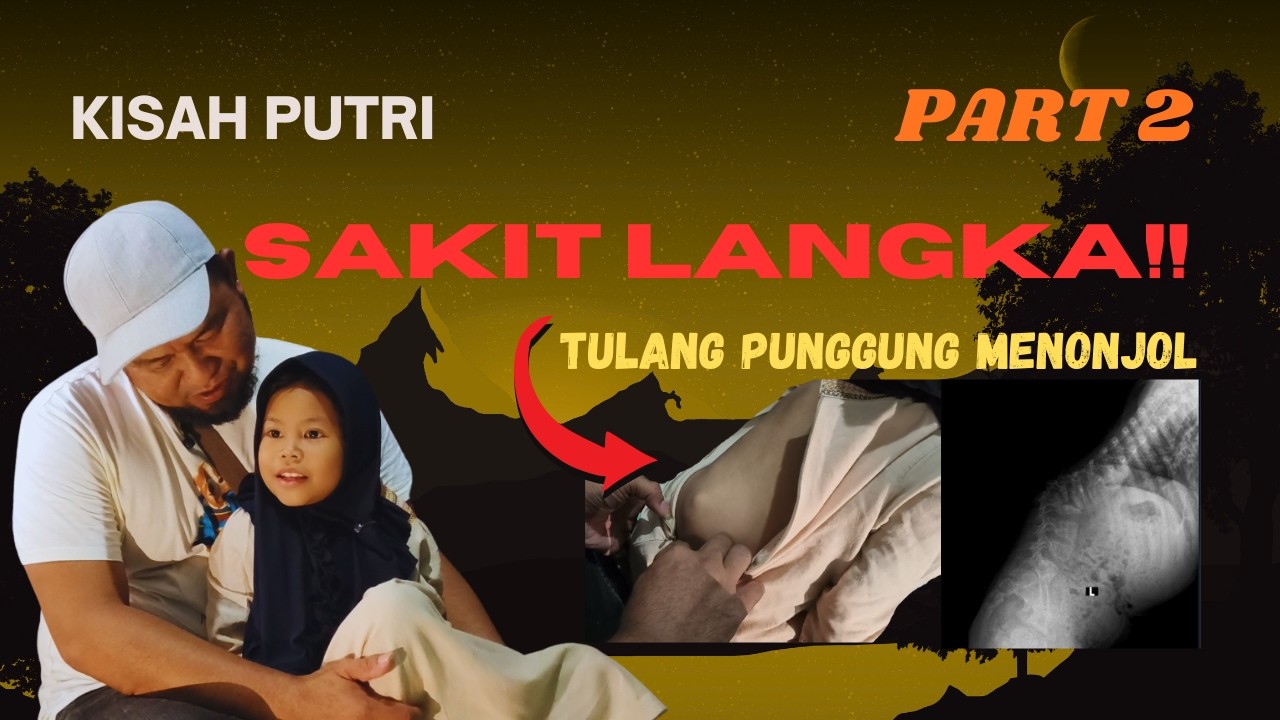 Anak Piatu dengan Penyakit Langka - Part 2