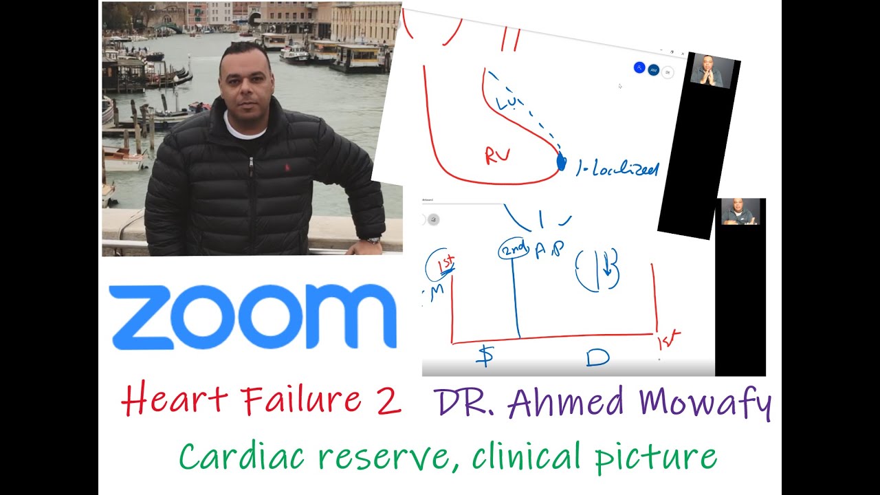 Dr Ahmed Mowafy Heart failure 2 Cardiac reserve & Clinical picture الحلقة الثانية  د. احمد موافي
