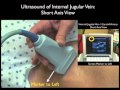 Ultrasound Guidance for Central Venous Access, Part 1