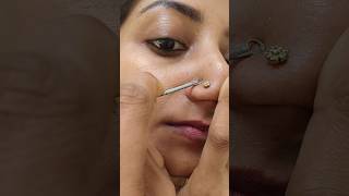 💯Remove Whiteheads in 5 Minutes | Easy Skincare Hack! #whiteheads #skincare #atypical_anjana 💯Remove Whiteheads in 5 Minutes | Easy Skincare Hack! #whiteheads #skincare #atypical_anjana